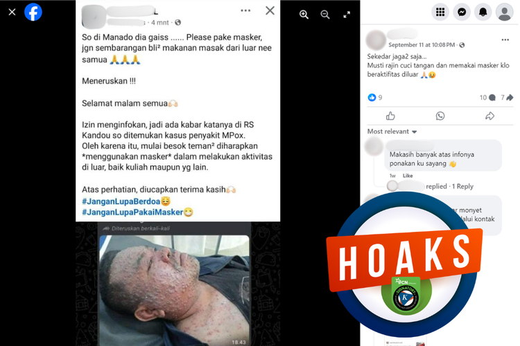 [VIDEO] Hoaks Pasien Mpox Dirawat di RSUP RD Kandou Manado, Simak Faktanya