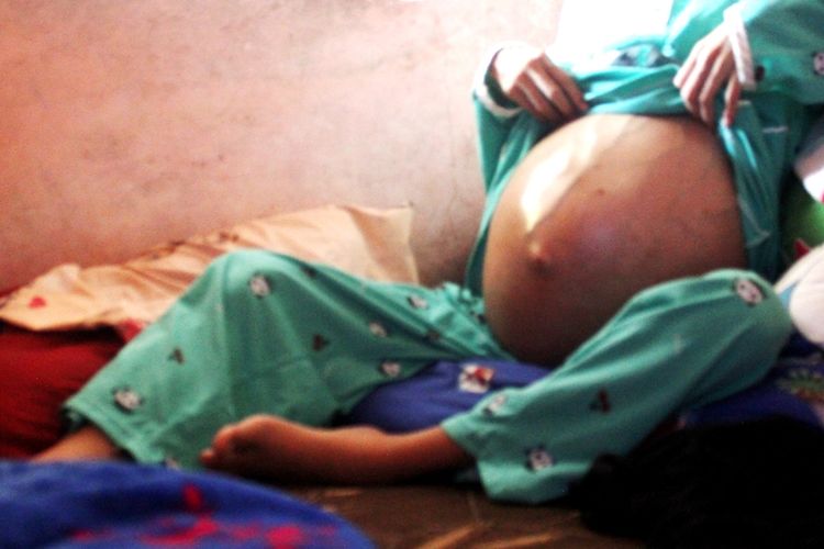 Kondisi Nur Mila Erianti (16), gadis asal Kabupaten Cianjur, Jawa Barat yang menderita kista ovarium yangberharap bisa mendapatkan bantuan agar bisa segera menjalani operasi.