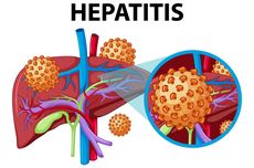 Apa Beda Hepatitis Akut dan Hepatitis Kronis?