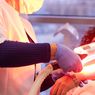 Efek Samping Menghilangkan Bulu Tubuh dengan Laser