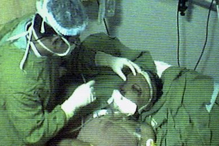 Kondisi terakhir Siti Nur Jazilah, pasien operasi transplantasi wajah di RSU Dr Soetomo Surabaya, Minggu (2/4/2006). Siti sudah bisa bernapas spontan tanpa alat bantu pernapasan.