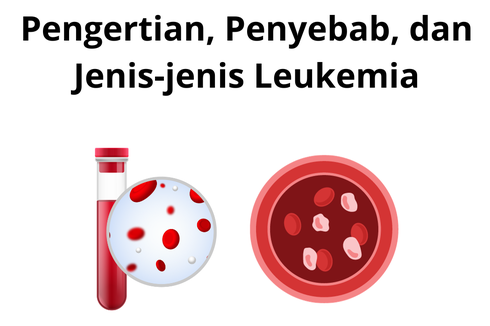 Pengertian, Penyebab, dan Jenis-jenis Leukemia