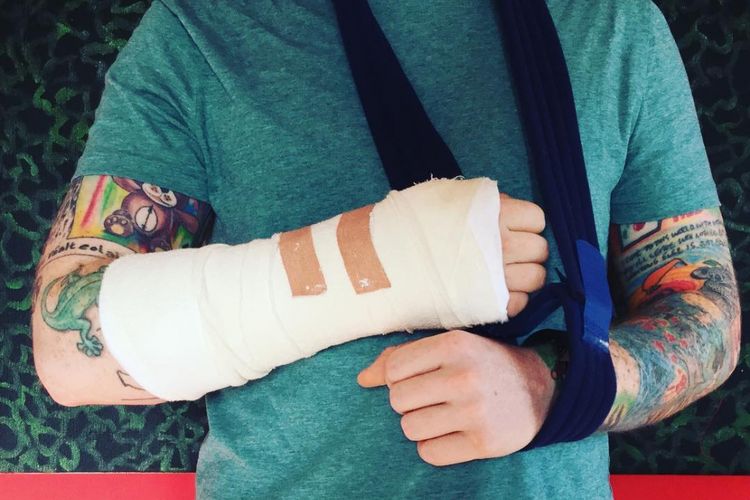 Ed Sheeran mengalami kecelakaan sepeda, akibatnya kedua tangannya retak.