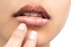 6 Tips Mengatasi Bibir Kering Saat Puasa