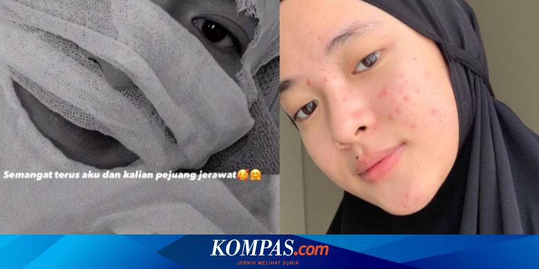 Mendadak Bagikan Foto Wajah Penuh Perban, Nissa Sabyan: Semangat Terus Aku - Vimarsana News
