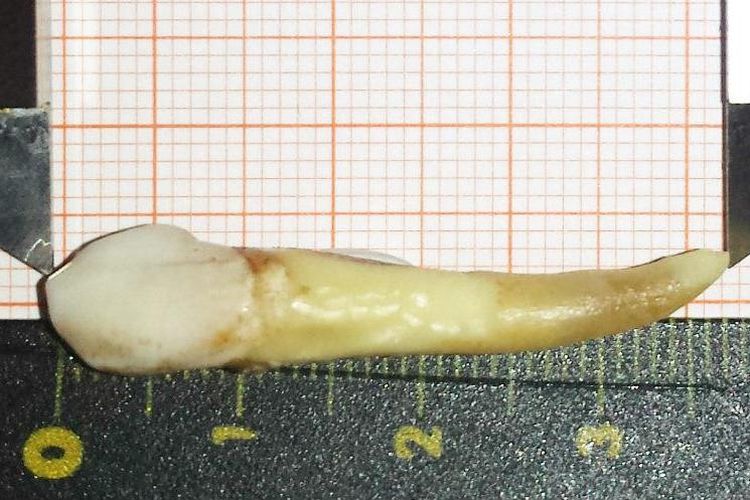 Gigi manusia terpanjang di dunia sepanjang 3,7 cm dicatatkan dalam Guinness World Records.