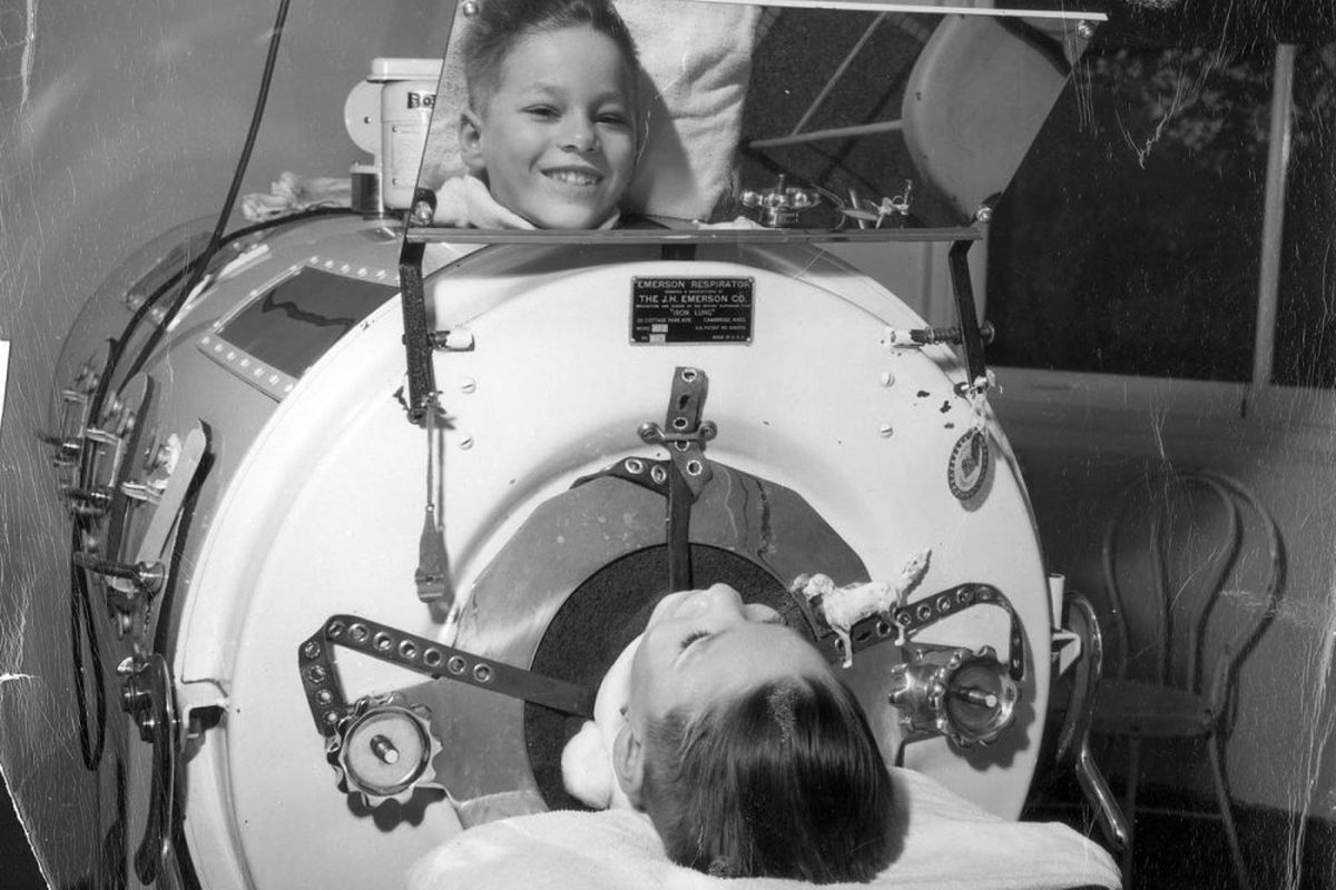 Ilustrasi iron lungs, ventilator pertama yang digunakan pada anak-anak yang terkena polio.