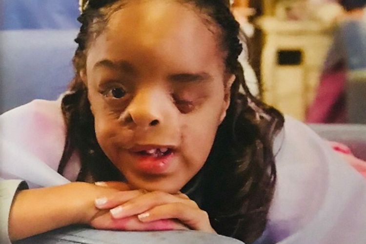 Destiny Strickland (11) ingin setiap orang tak menyembunyikan perbedaan yang ada pada diri mereka. 