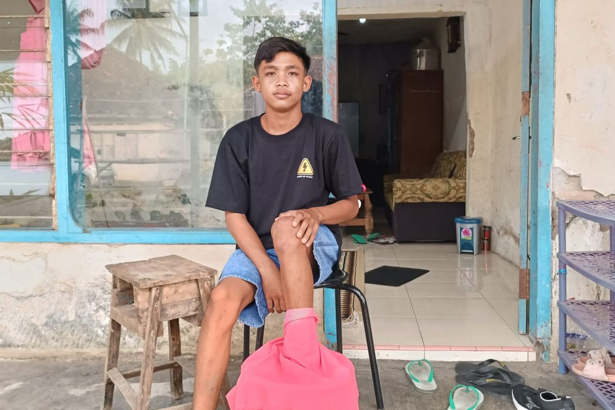 Korban selamat Tragedi Kanjuruhan, Nur Saguanto saat merendam kakinya di dalam air hangat dan garam, Kamis (3/11/2022).