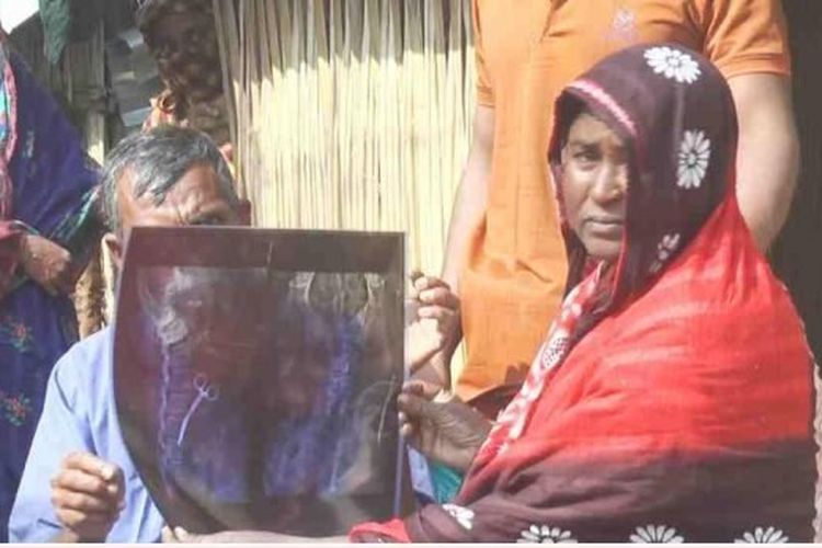 Seorang wanita di Bangladesh, Bachena Khatun, 55, menunjukkan hasil rontgen yang menggambarkan adanya gunting bedah di perutnya. Dia melakukan rontgen setelahmengeluh sakit perut terus-menerus selama 20 tahun terakhir.
