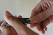 Benarkah Orang Berkurban Tak Boleh Potong Kuku & Rambut? ini Hukumnya