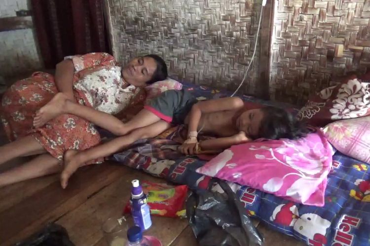 Seorang korban diduga keracunan pindang ikan mas di Sindangbarang, Cianjur saat menjalani perawatan medis di rumahnya. Sebanyak 52 warga setempat mengalami keracunan dan dua di antaranya meninggal dunia.