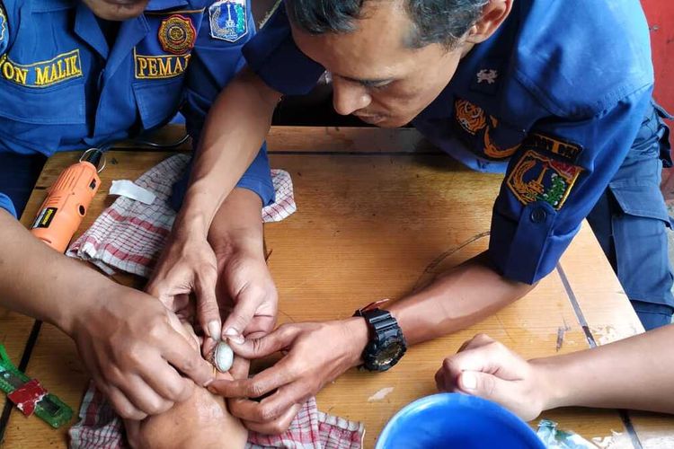 Petugas Suku Dinas Penanggulangan Kebakaran dan Penyelamatan (Sudin PKP) Jakarta Timur melepaskan cincin dari jari manis warga asal Depok bernama Yudi, Jumat (13/12/2019).