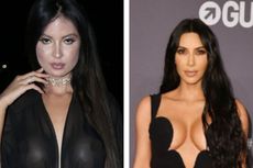 Habiskan Rp 8 Miliar agar Mirip Kim Kardashian, Model Ini Menyesal