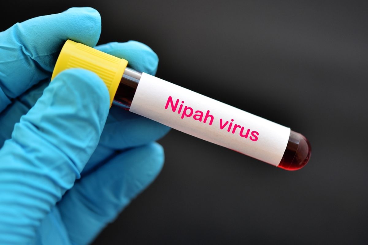 Ilustrasi virus nipah, gejala virus nipah, bahaya virus nipah. Infeksi virus nipah tengah mewabah di India. Kenali gejala dan bahaya virus nipah. 