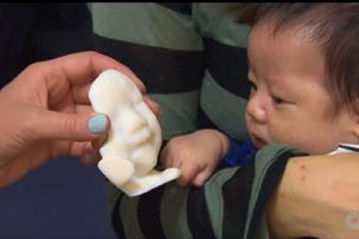 BioTexture mampu mencetak wajah bayi sejak sebelum lahir.