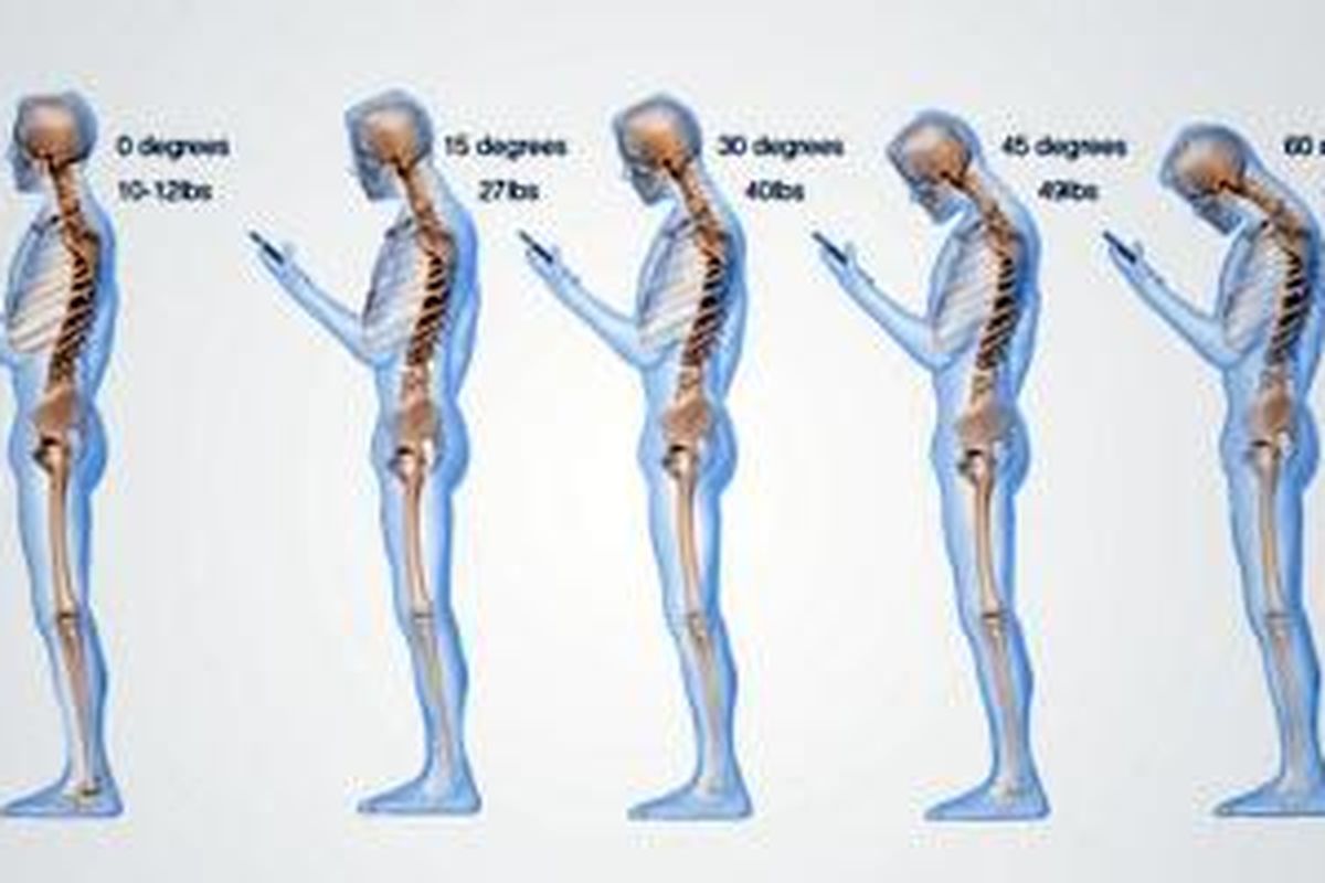 Tekanan yang ditanggung oleh leher dan tulang punggung sebagai hasil menunduk untuk melihat smartphone (Courtesy Dr. Ken Hansraj M.D.)