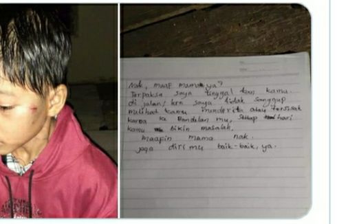 Foto Viral Anak Laki-laki Dibuang Orangtuanya, di Wajahnya Ada Luka dan Disertai Selembar Surat