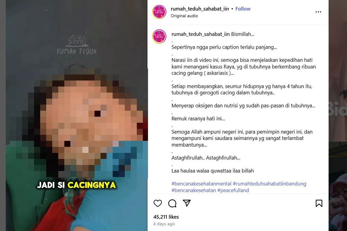 Raya, bocah berusia tiga tahun asal Kampung Padangenyang, Desa Cianaga, Kecamatan Kabandungan, Kabupaten Sukabumi, Jawa Barat, meninggal dengan tubuh dipenuhi cacing
