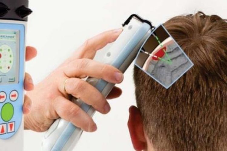 Pemindai cedera kepala bakal digunakan di olahraga tinju. Butuh waktu sekitar tiga menit untuk memeriksa kepala seseorang dengan alat tersebut.