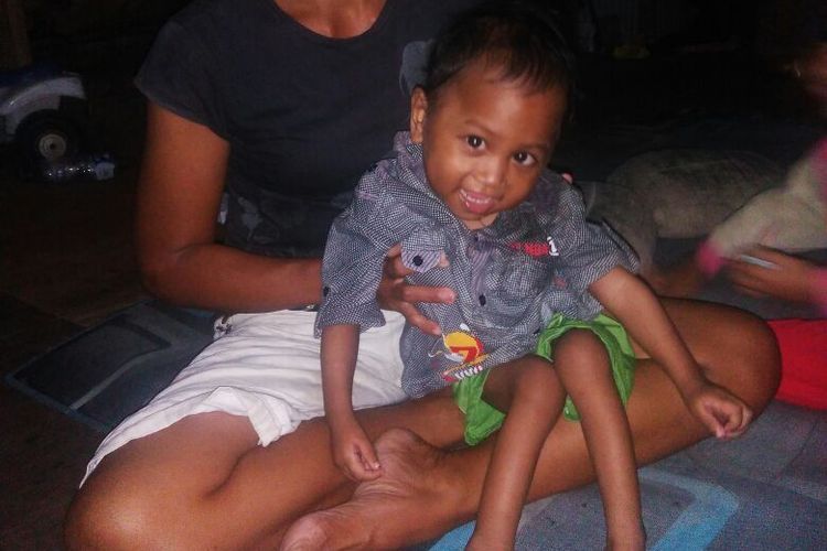Hari Cerebral Palsy Sedunia, Kenali 4 Jenis dan Penyebab Lumpuh Otak