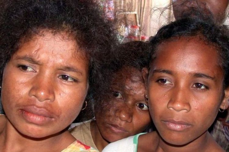 Pengungsi perempuan Timor Timur mendengarkan ketika pengungsi lain menggambarkan kondisi kehidupan mereka yang buruk di kamp Noelbaki di luar Kupang 09 Mei 2002