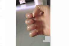 Video Viral Kuku Disebut Alami Clubbing Finger, Benarkah Tanda Penyakit Jantung?