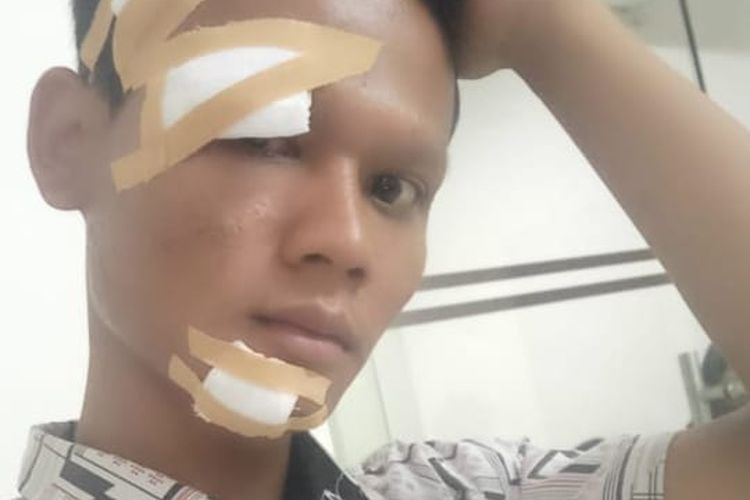 Wawan (22) mengalami babak belur setelah keroyok oleh sejumlah pemuda saat mendatangi rumah kekasihinya berinisial SW (21) di Jalan Kampung Parigi Baru, Pondok Aren, Kota Tangerang Selatan.  