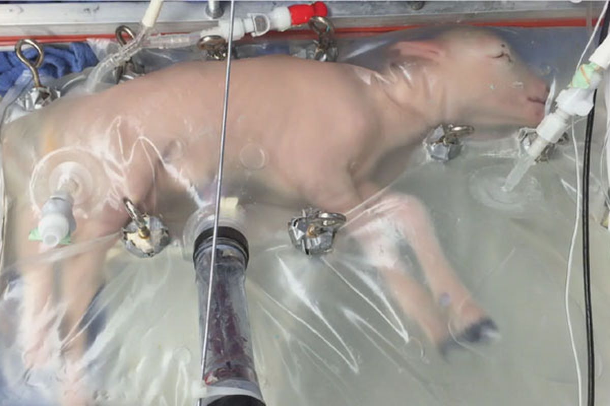 Kandungan buatan bernama Biobag ini diciptakan untuk janin yang terlahir prematur.