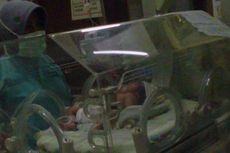 Bayi Berkepala Dua Tidak Bisa Dioperasi untuk Pemisahan Kepala