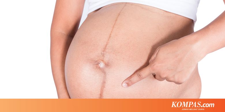 Kenali Linea Nigra, Garis Samar yang Ada di Perut Perempuan