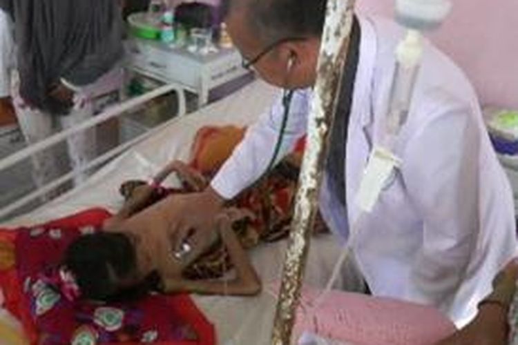 Dua bocah penderita gizi buruk yang ditangani RSUD Polewali Mandar, Sulawesi Barat, ditangani dua dokter spesialis gizi dan anak.
