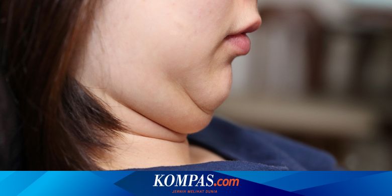 Olahraga Hingga Operasi, Ini Cara Menghilangkan Double ...