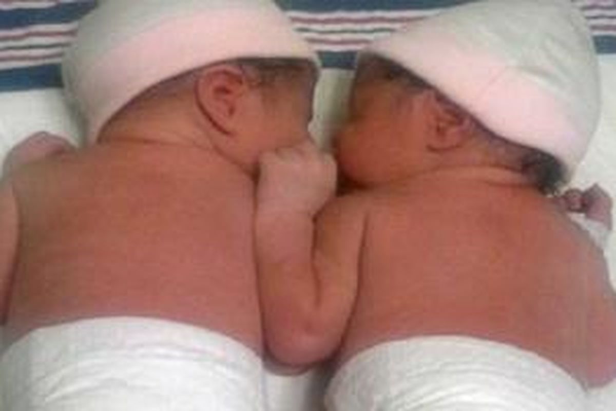 Bayi kembar