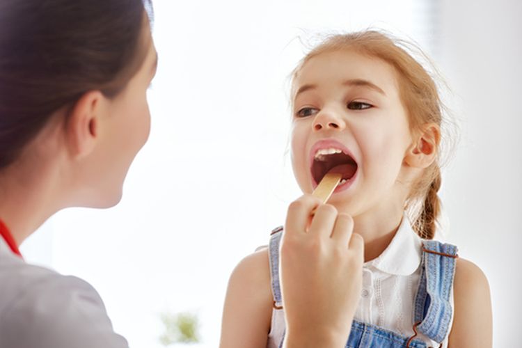 Ilustrasi tonsilitis. Pemeriksaan amandel untuk melihat ada tidaknya gejala tonsilitis. Penyebab tonsilitis biasanya karena infeksi virus dan bakteri. Kenali ciri-ciri amandel pada anak terganggu dan cara mengobatinya. 