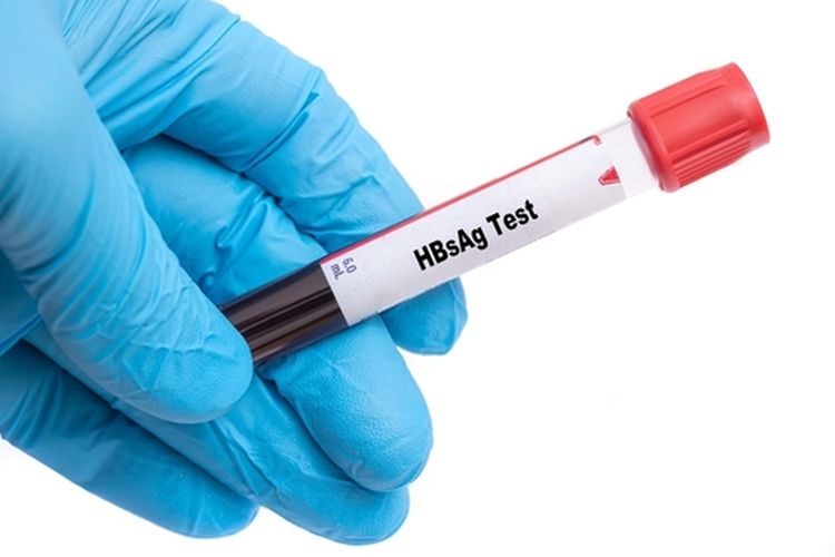 Ilustrasi tes hepatitis B, pemeriksaan HBsAg, tes untuk mendeteksi penyakit hepatitis B
