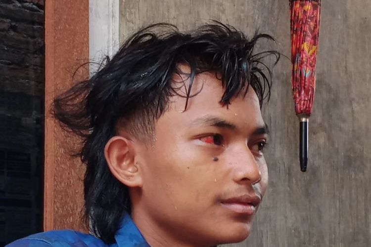 M Iqbal Maulana (17), Aremania yang selamat dari tragedi di Stadion Kanjuruhan. 