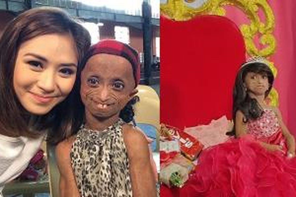 Ana Rochelle Pondare yang mengalami kondisi genetik langka disebut progeria, berpose bersama selebriti idolanya asal Filipina, Sarah Geronimo.