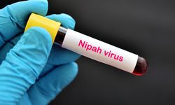 Rekam Jejak Virus Nipah di Indonesia dan Potensi Penularannya 