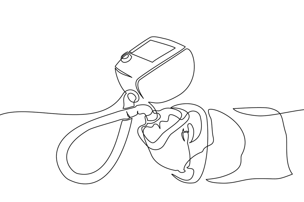 Ilustrasi pasien dengan bantuan ventilator