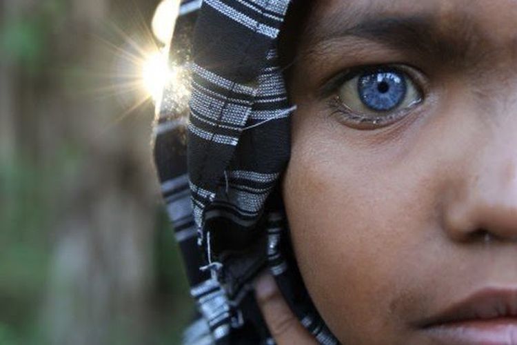 Seorang anak dari Suku Buton memiliki mata berwarna biru di Kendari, Sulawesi Tenggara, Selasa, 15 September 2020. 
