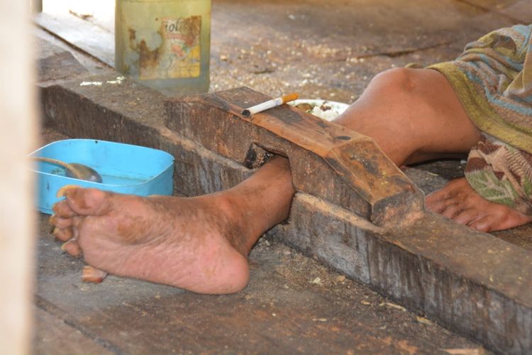 Maximilianus Bombang (41) yang di pasung di pondoknya di Kampung Gulung, Desa Pong Ruan, Kec. Kota Komba, Kab. Manggarai Timur, Flores, NTT, Jumat, (1/11/2019). (KOMPAS.com/MARKUS MAKUR)