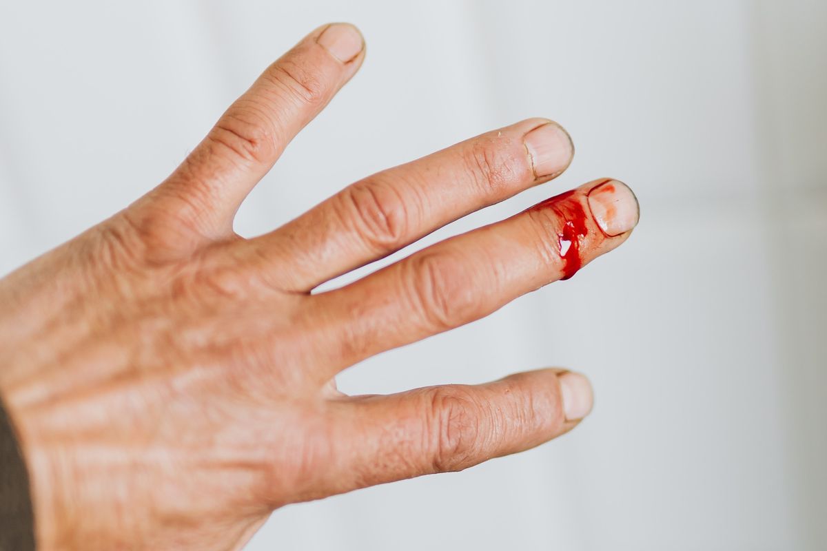 Pendarahan akibat luka harus ditangani dengan benar agar terhindar dari infeksi. 