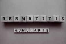 Dermatitis Numularis