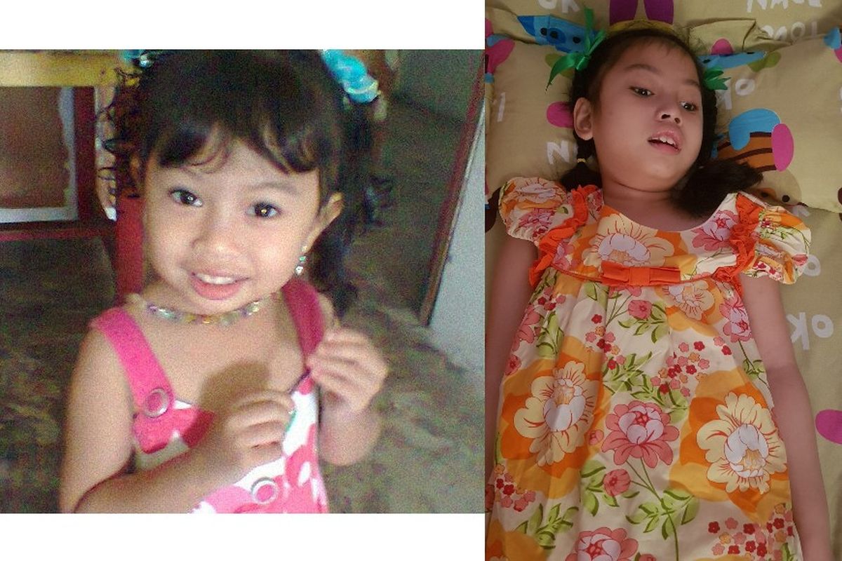 Foto kiri: saat Syafa berusia 3 tahun, foto kanan: saat Syafa berusia 8 tahun