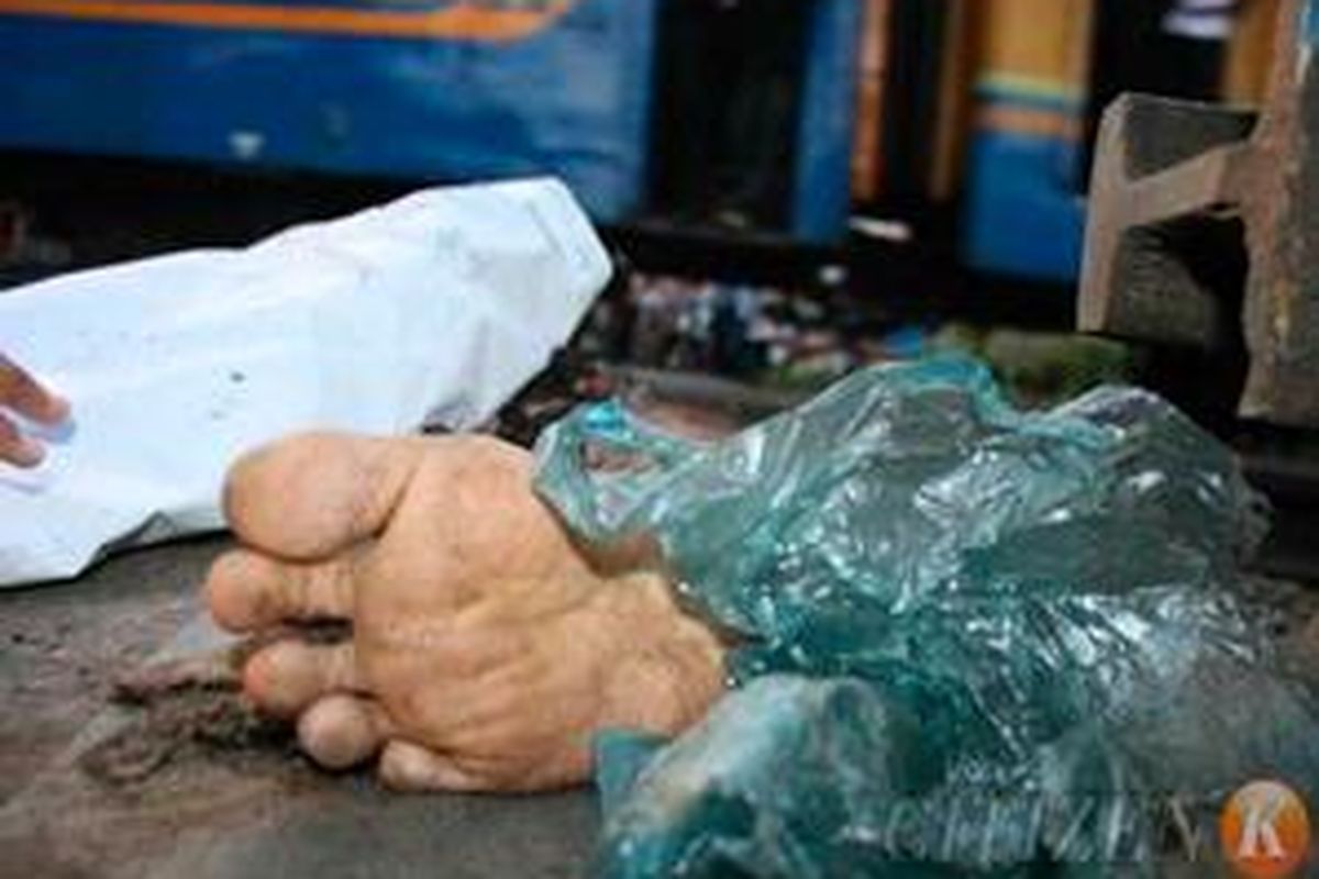 Kaki warga yang terpotong diseret kereta api di Jatinegara.