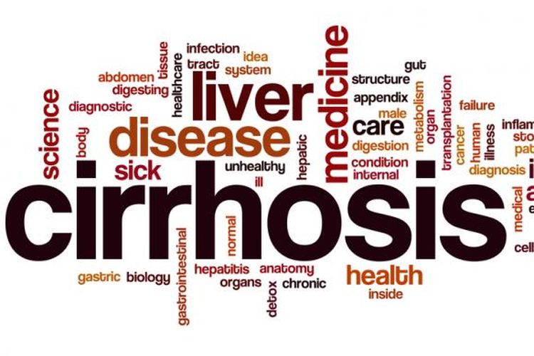 Lebih dari setengah jumlah pasien yang terdiagnosis mengalami kanker hati biasanya mengidap sirosis.
