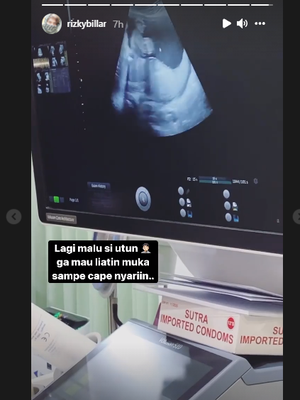 Rizky Billar tunjukkan hasil USG kehamilan Lesti Kejora.