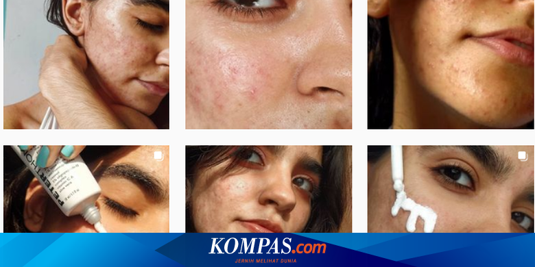 5 Beauty Influencer Tunjukkan Cara Cintai Kulit meski Tak Sempurna - Vimarsana News