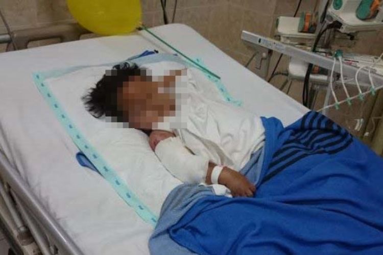 Rismawati (3) tidur lelap di ruang perawatan HCU. Rismawati mengalami luka bakar 70 persen setelah tersiram kuah bakso yang baru mendidih.